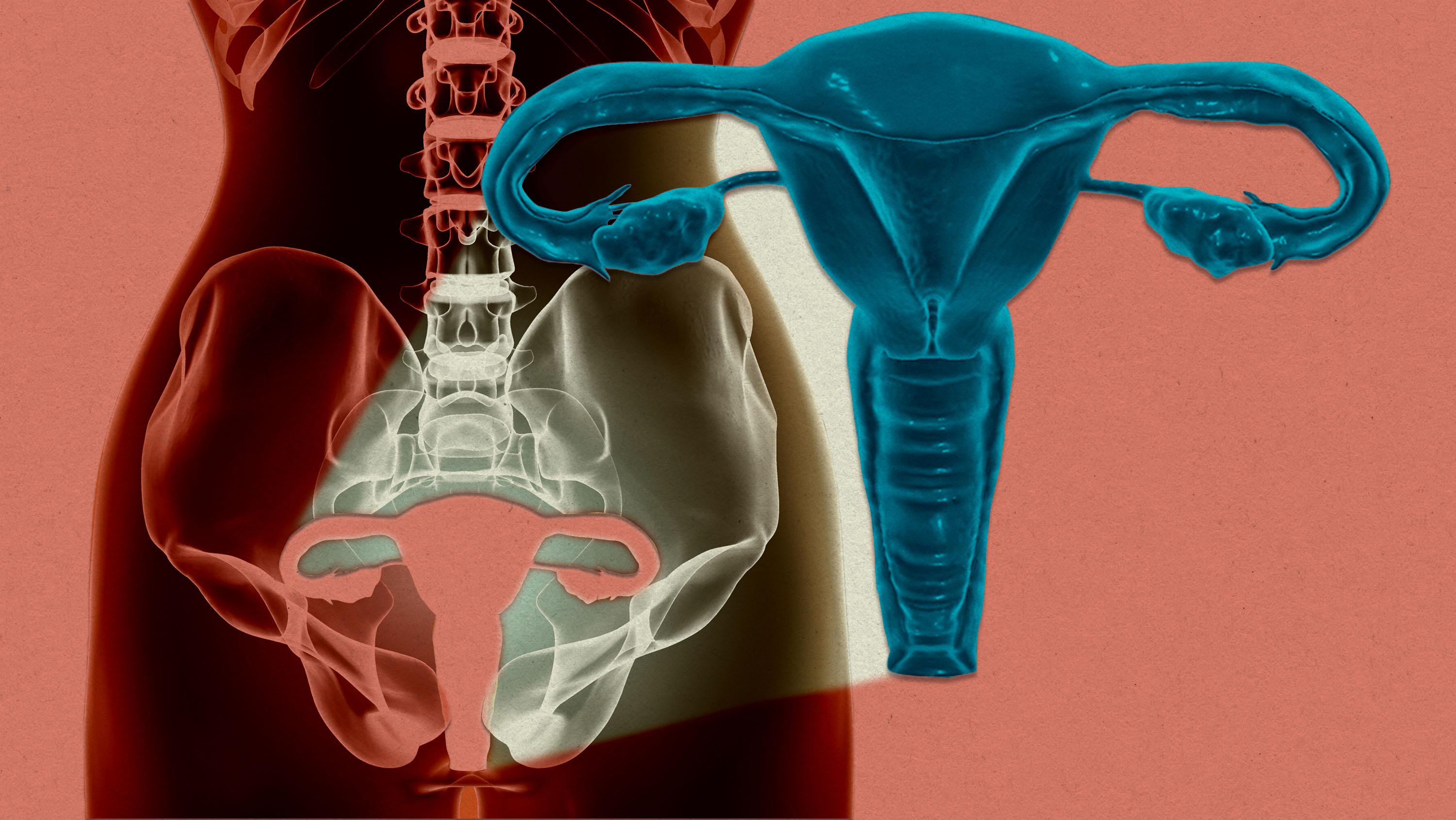 A photo illustration shows the uterus outside of the body.