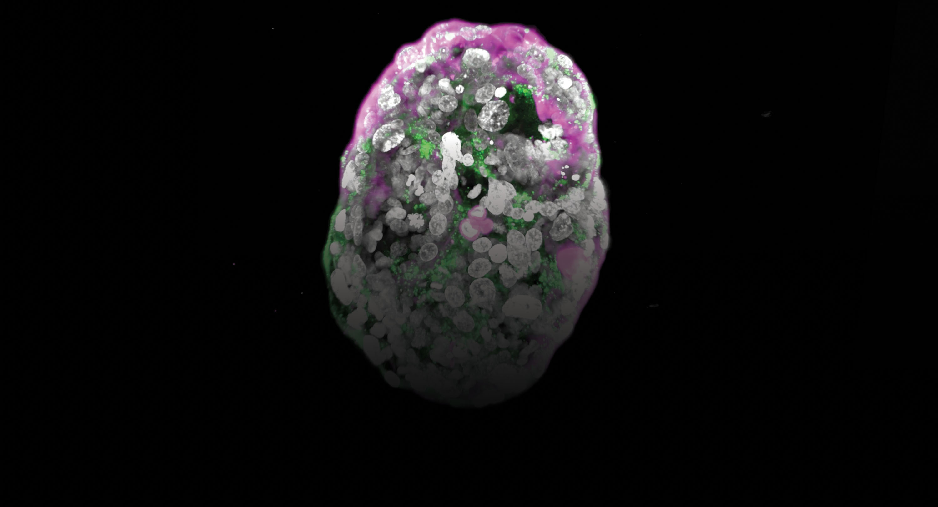 Created in Jacob Hanna’s lab, this “model” made from stem cells resembles a two-week-old human embryo. Tracers highlight the presence of the hormone detected by pregnancy tests (green) and the layer that will become the placenta (pink).